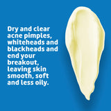 De La Cruz 5% Sulfur Ointment - Cystic Acne Treatment for Face and Body - Daily 10 Min Spot Treatment Mask - Safe and Effective Game Changing Hormonal Acne Treatment that Clears Up Pimples 2.6oz Tube