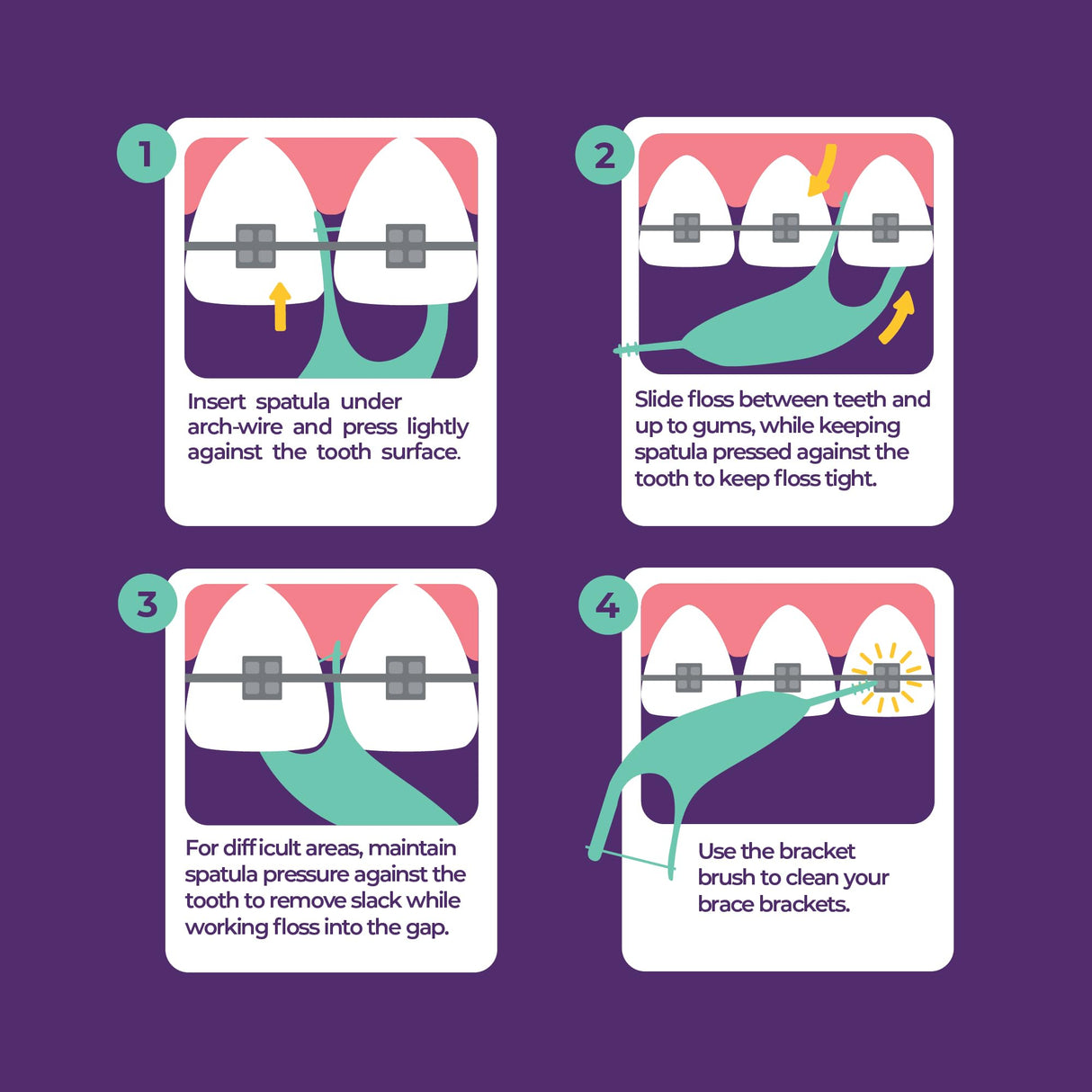 Platypus Orthodontic Flossers for Braces | Ortho Picks for Adults & Kids | Fits Under Arch Wire | Non-Damaging | Encourage Flossing Habits | Floss Teeth in Under Two Minutes (40 Count (Pack of 4))