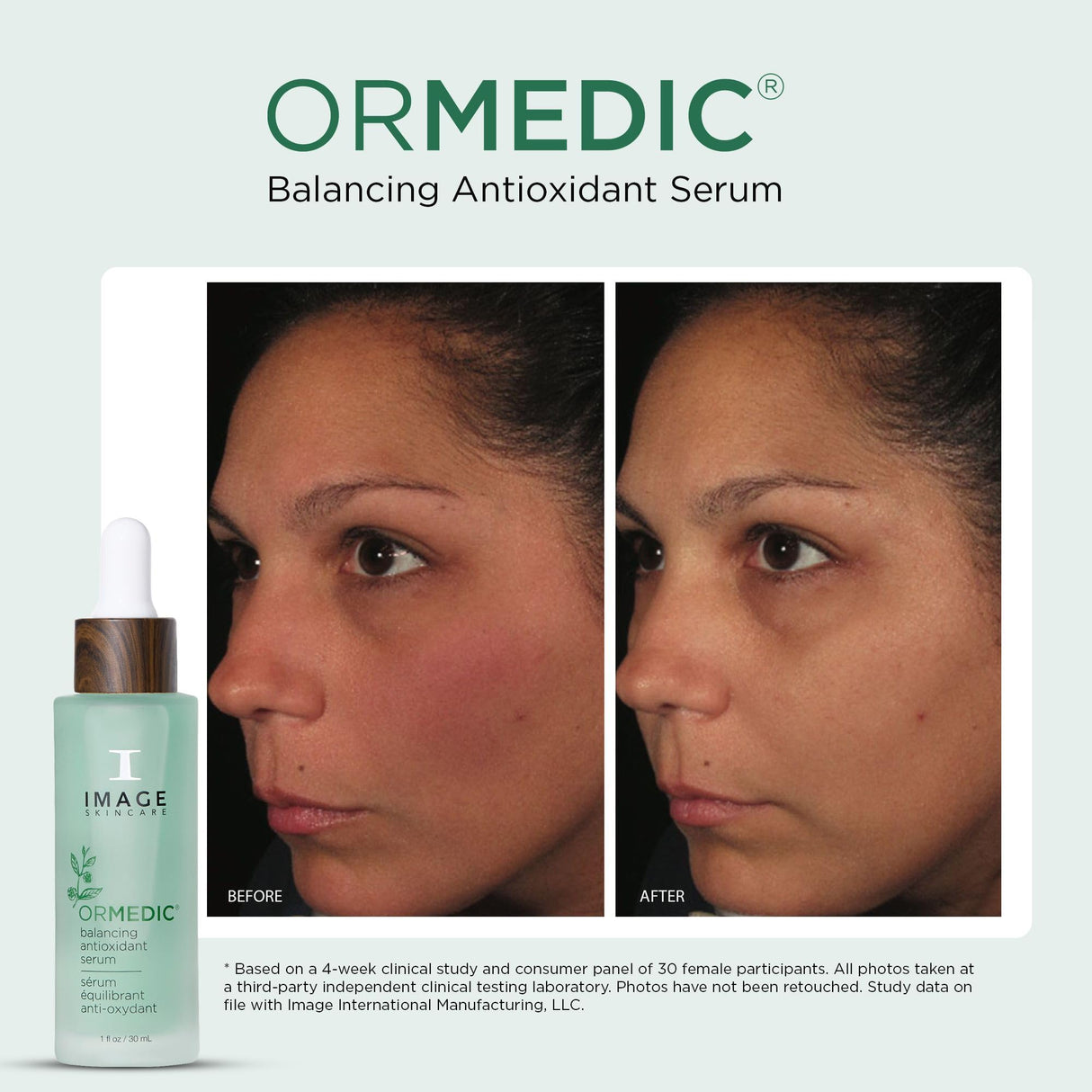 Image Skincare Ormedic Balancing Anti Oxidant Serum 30 ml / 1 oz
