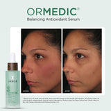 Image Skincare Ormedic Balancing Anti Oxidant Serum 30 ml / 1 oz