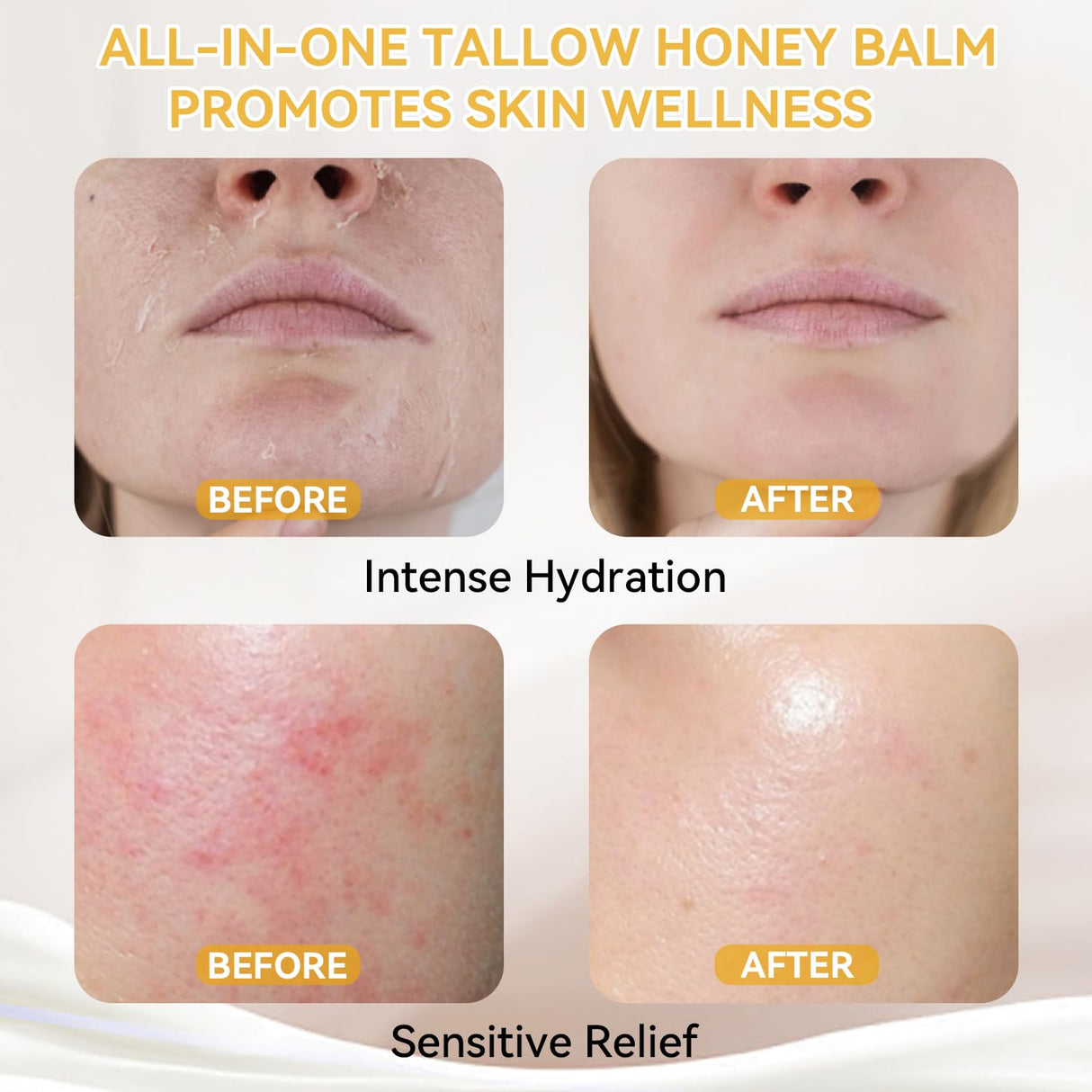 Beef Tallow for Skin, Whipped Tallow and Honey Balm, Organic Grass-Fed Beef Tallow with Raw Honey & Beeswax Natural Moisturizer for Face & Body, Nourish and Soothe Sensitive, Dry Skin