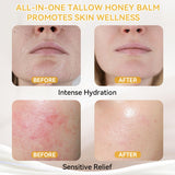 Beef Tallow for Skin, Whipped Tallow and Honey Balm, Organic Grass-Fed Beef Tallow with Raw Honey & Beeswax Natural Moisturizer for Face & Body, Nourish and Soothe Sensitive, Dry Skin