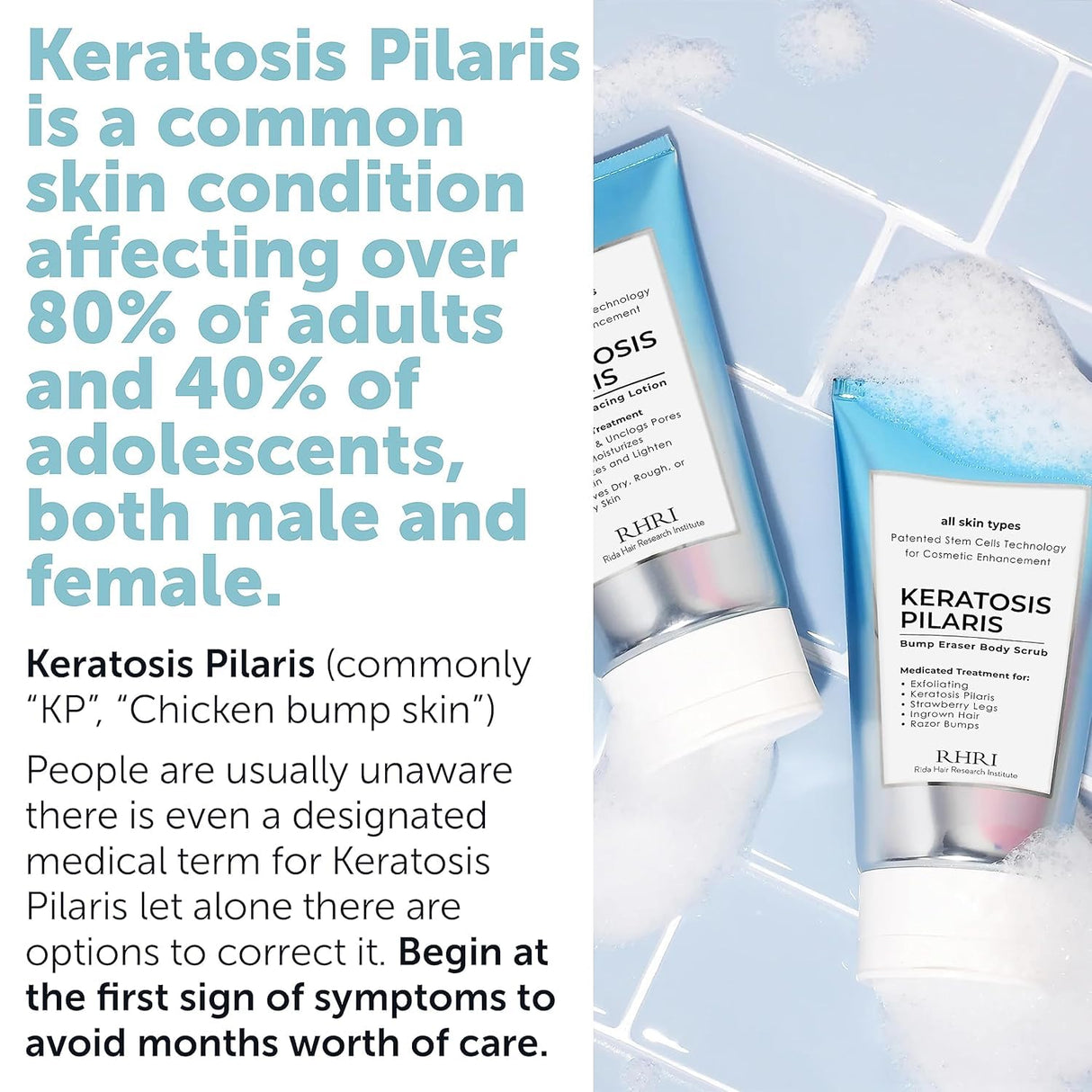 KP Bump Eraser Body Set | Keratosis Pilaris Treatment | Keratosis Pilaris Lotion | Exfoliating Body Scrub | Ingrown Hair Treatment | Bundle Set for Bump, Strawberry Legs, Redness, Dry & Flakey Skin