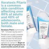 KP Bump Eraser Body Set | Keratosis Pilaris Treatment | Keratosis Pilaris Lotion | Exfoliating Body Scrub | Ingrown Hair Treatment | Bundle Set for Bump, Strawberry Legs, Redness, Dry & Flakey Skin
