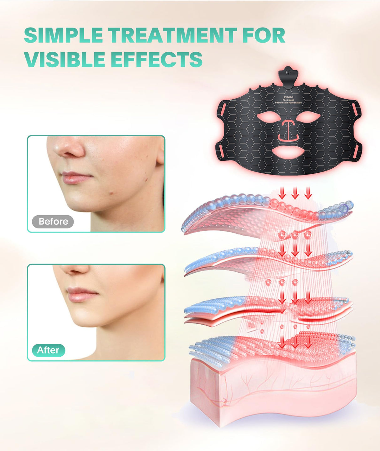 EVFOFO Red Light Therapy Mask for Face, 7 Colors LED Face Mask Light Therapy At Home, Led Face Mask Light Therapy, Black