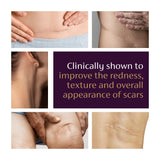 Mederma Advanced Scar Gel, Cepalin Scar Treatment, Old and New Scars, 20g