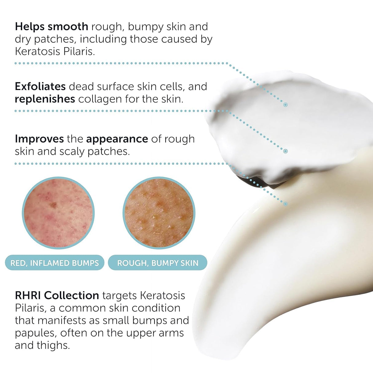 KP Bump Eraser Body Set | Keratosis Pilaris Treatment | Keratosis Pilaris Lotion | Exfoliating Body Scrub | Ingrown Hair Treatment | Bundle Set for Bump, Strawberry Legs, Redness, Dry & Flakey Skin