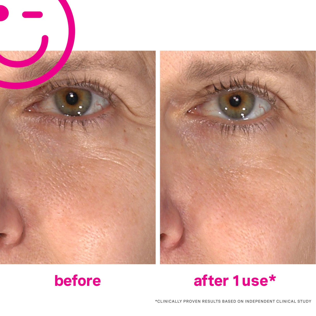 Kate Somerville Wrinkle Warrior | 2-In-1 Plumping Moisturizer + Face Serum | Instantly Hydrates & Smooths Skin | 1.7 Fl Oz