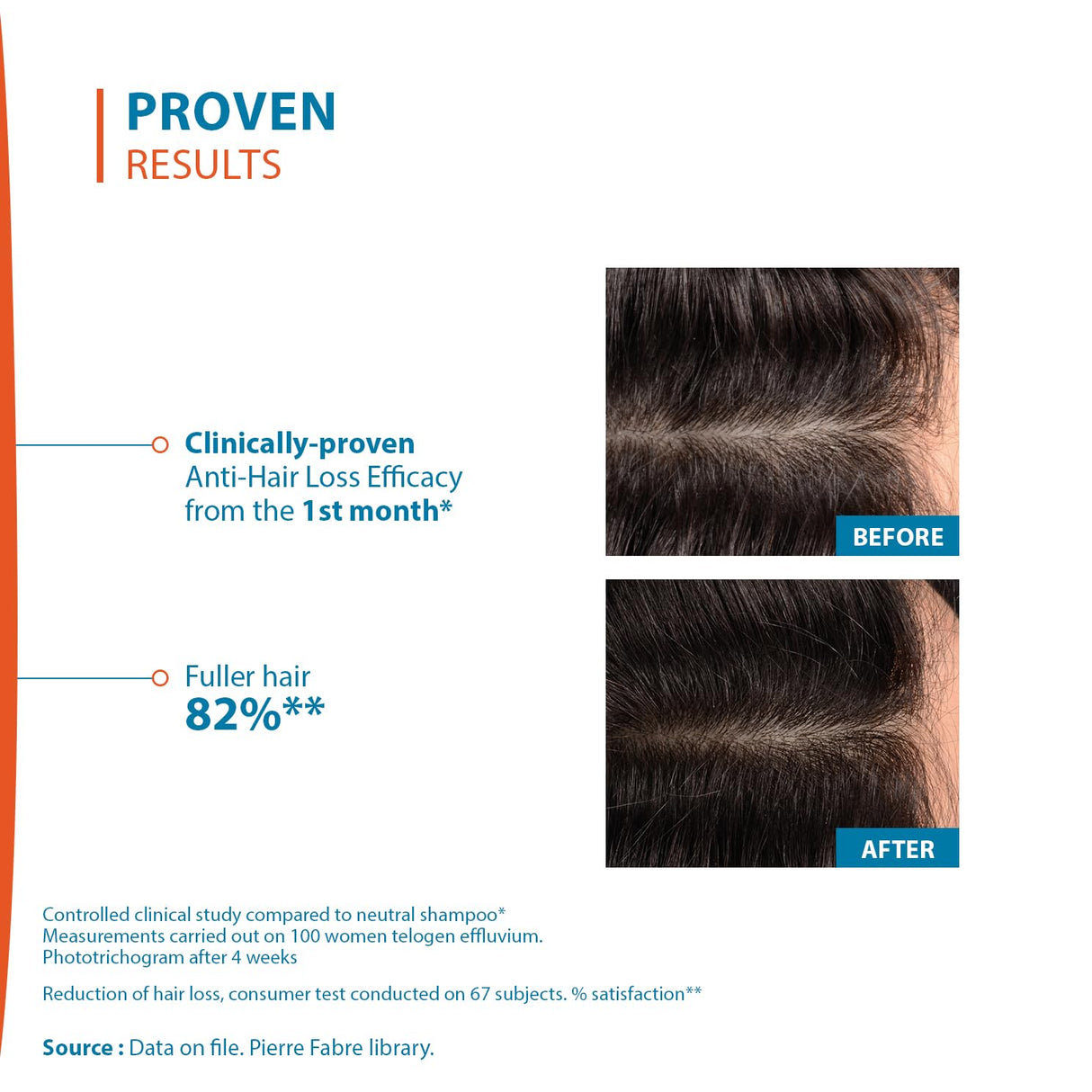 Ducray Creastim Reactiv Hair Loss Lotion 60 ml