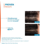 Ducray Creastim Reactiv Hair Loss Lotion 60 ml