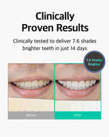 Live Orals PureDia Teeth Whitening Kit - Gel & Mouthpiece Set, Hydrogen Peroxide, Dentist Formulated for Sensitive Teeth, 28 Treatments.