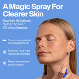 Magic Molecule Skin Spray, Hypochlorous Acid Formula, 8oz