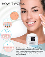 Dark Spot Remover for Face and Body: Hyperpigmentation Treatment - Natural Ingredient - Freckle/Melasma/Sun Spot/Age Spot Remover - Dark Spot Corrector Cream for Women and Men