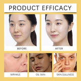 Agicea Turmeric Soap Bar, Lemon Turmeric-Soap Bar for Face and Body, TurmericFace Wash Cleansing Soap for All Skin Types (2)