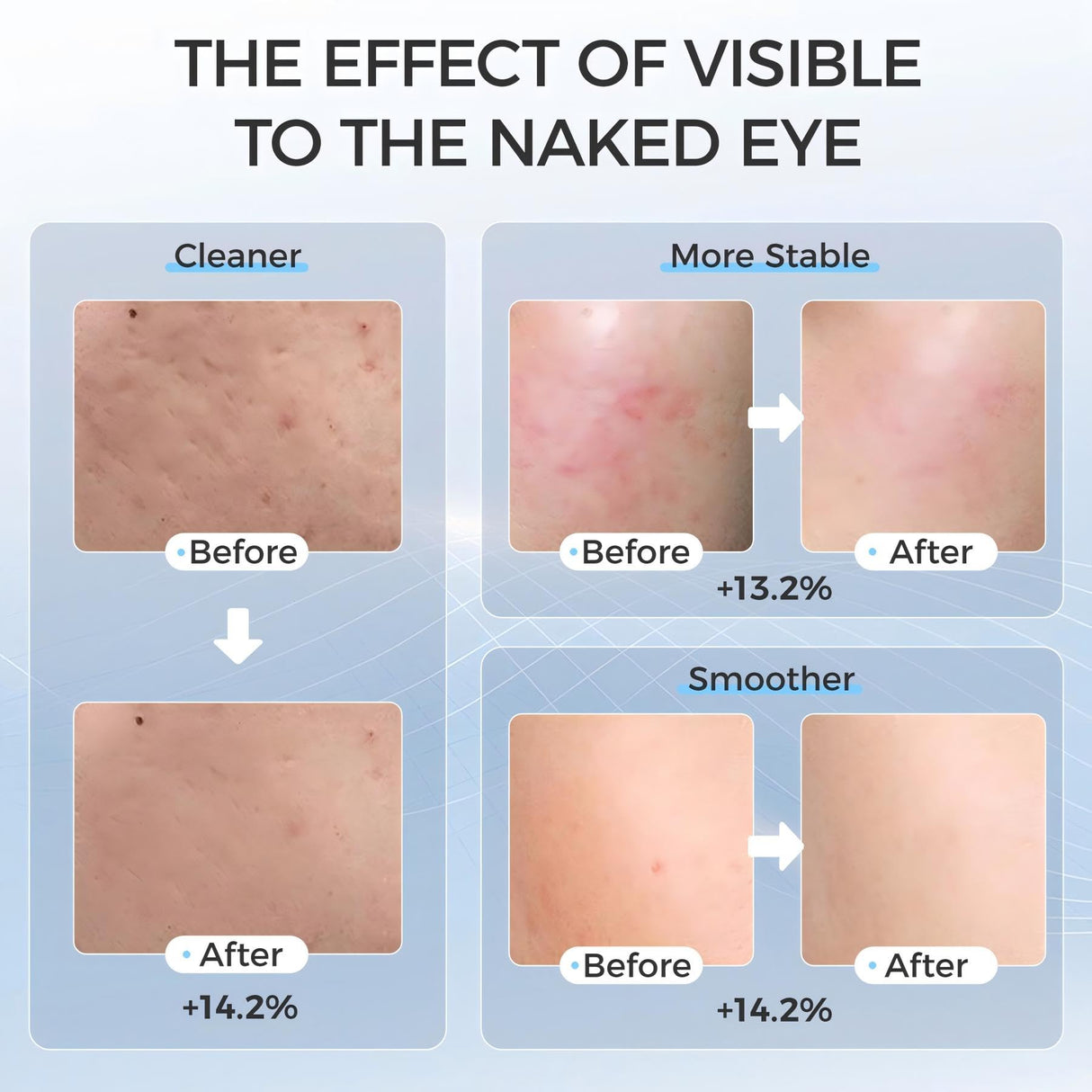 EVFOFO Led Face Mask Light Therapy, Red Light Therapy for Face, 7-1 Colors LED Facial Skin Care Mask, Black