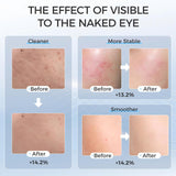 EVFOFO Led Face Mask Light Therapy, Red Light Therapy for Face, 7-1 Colors LED Facial Skin Care Mask, Black