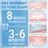 Kunyle Silicone Scar Gel, Scar Cream, Advanced Scar Gel for Surgical Scars, Stretch Marks, Keloid Bump Removal, Old and New Scars 0.70oz (20g)