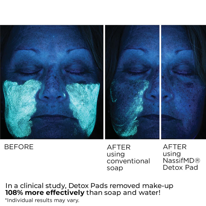 NassifMD Detox Pads Facial Radiance Pads, Glycolic Acid Pads, Face Exfoliating Pads Salicylic Acid Wipes, Facial Scrub Pads, BHA AHA Pads, Resurfacing Pads for Face (60 Count)