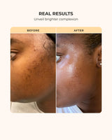 Buttah Skin Supreme Kit for Melanin Rich Skin | Oil-Free Hyaluronic Gel Cream 2 oz | Vitamin C Serum 1 oz | Cleanser 3.4 oz | Rosewater Toner 3.4 oz | Black Owned Skincare