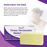 Naturasil Tinea Versicolor Treatment +2 Bars | Max-Strength 10x Soap | Antifungal Micronized Sulfur | Stops Pityriasis, Candida, Ringworm & Irritation | Fast Acting Adult & Kid Safe | 4 oz (2 Pack)