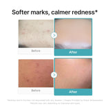 medicube Azelaic Acid 10 Soothing Serum