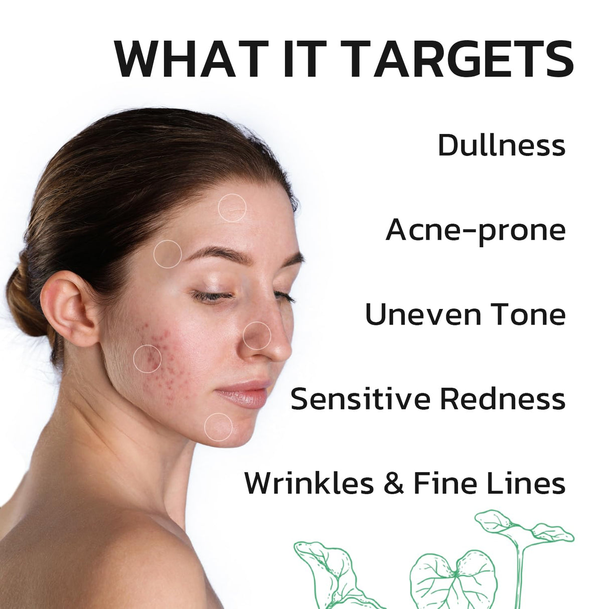 GNJOY Centella Moisturizer Phytocin Cream Soothing Centella Asiatica Moisturizer Face Hydration Barrier Repair Calming PDRN Cream for Acne Prone, Sensitive Skin, Ceramide, B5, Salmon (30ml)