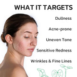 GNJOY Centella Moisturizer Phytocin Cream Soothing Centella Asiatica Moisturizer Face Hydration Barrier Repair Calming PDRN Cream for Acne Prone, Sensitive Skin, Ceramide, B5, Salmon (30ml)