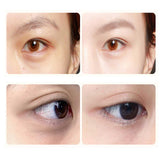 Lutein Eye Essence Oil, Lutein Eye Wrinkle Essence Oil, Vc Lutein Eye Essence Oil, Lutein Eye Oil, Lutein Eye Firming Serum, Reduces Fine Lines Under The Eyes (1pcs)