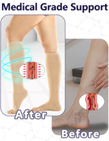 +MD 2 Pairs Compression Socks for Women & Men Medical Grade 20-30 mmHg, Open-Toe knee High Stocking, Support for edema, Varicose Veins, Nude, X-Large