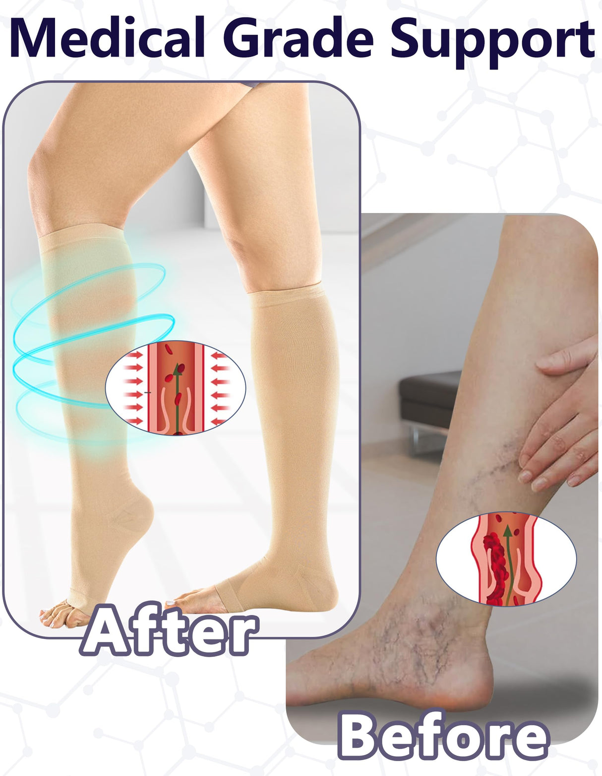 +MD 2 Pairs Compression Socks for Women & Men Medical Grade 20-30 mmHg, Open-Toe knee High Stocking, Support for edema, Varicose Veins, Nude, Large