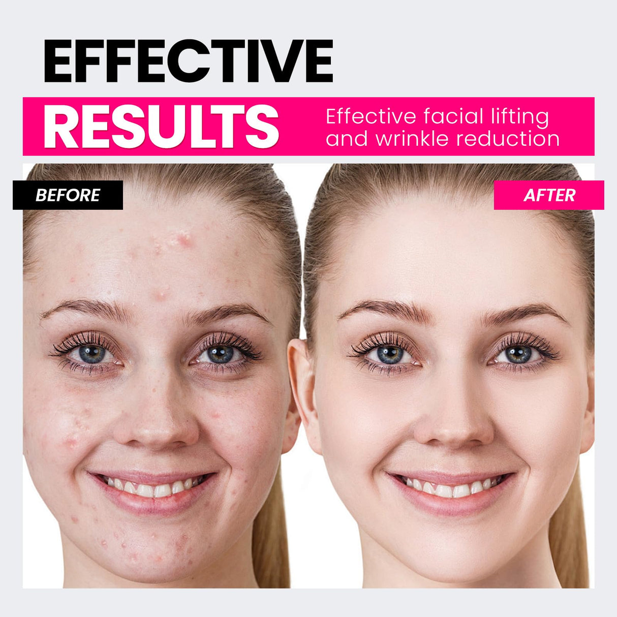 Hunvva Microcurrent Facial Device,Latest Red Light Technology,Enhances The Ability to Lift The Face and Tighten The Skin,Facial Wrinkle Equipment,Smart Photon Micro-Current Device,Model:EP-300.