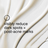 Clinique Even Better Clinical Dark Spot Clearing Serum With Vitamin C | Brightening + Soothing, 2.5 Fl Oz