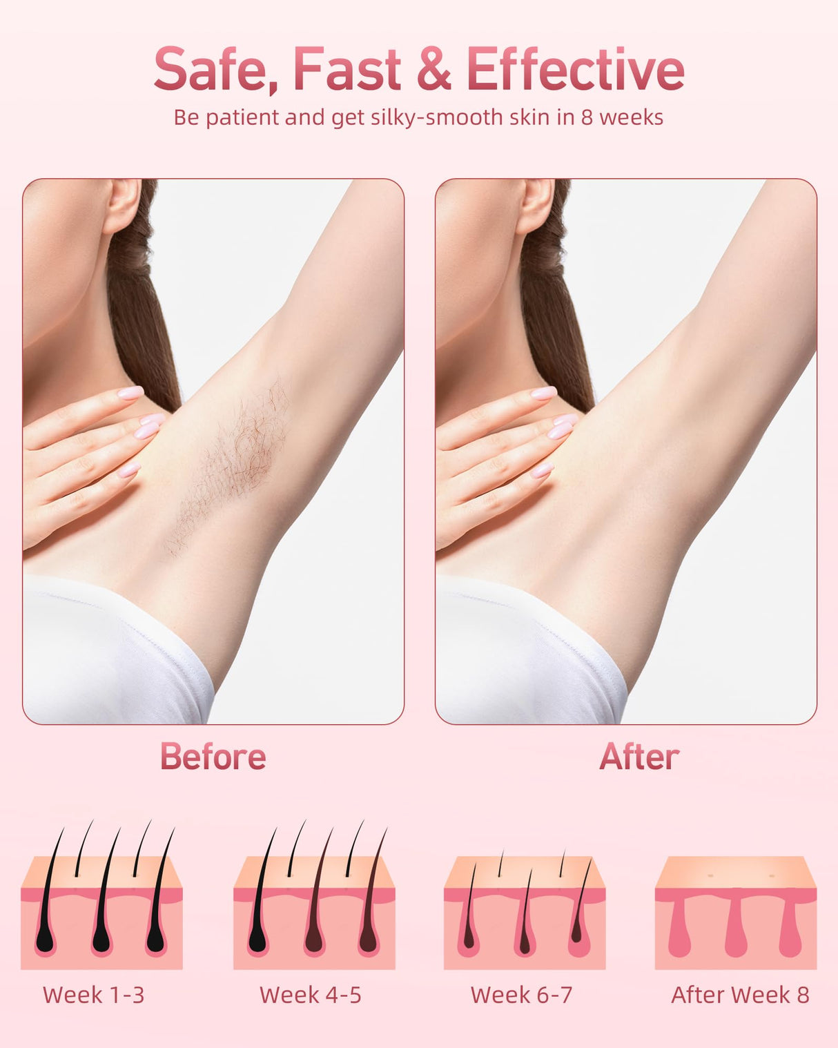 Hair Removal Device, IPL Hair Removal, Laser Hair Removal for Women and Men 999,999 Flashes Permanent for Facial Facial Legs Arms Bikini Line Whole Body Use at-Home(Model: TFDA06S-A)