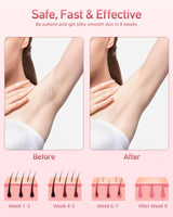 Hair Removal Device, IPL Hair Removal, Laser Hair Removal for Women and Men 999,999 Flashes Permanent for Facial Facial Legs Arms Bikini Line Whole Body Use at-Home(Model: TFDA06S-A)