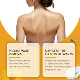 4 Pack Bee Venom Wart and Tag Remover, Bee Venom Mole and Wart Treatment Cream, Tag Recede Bee Venom for Skin