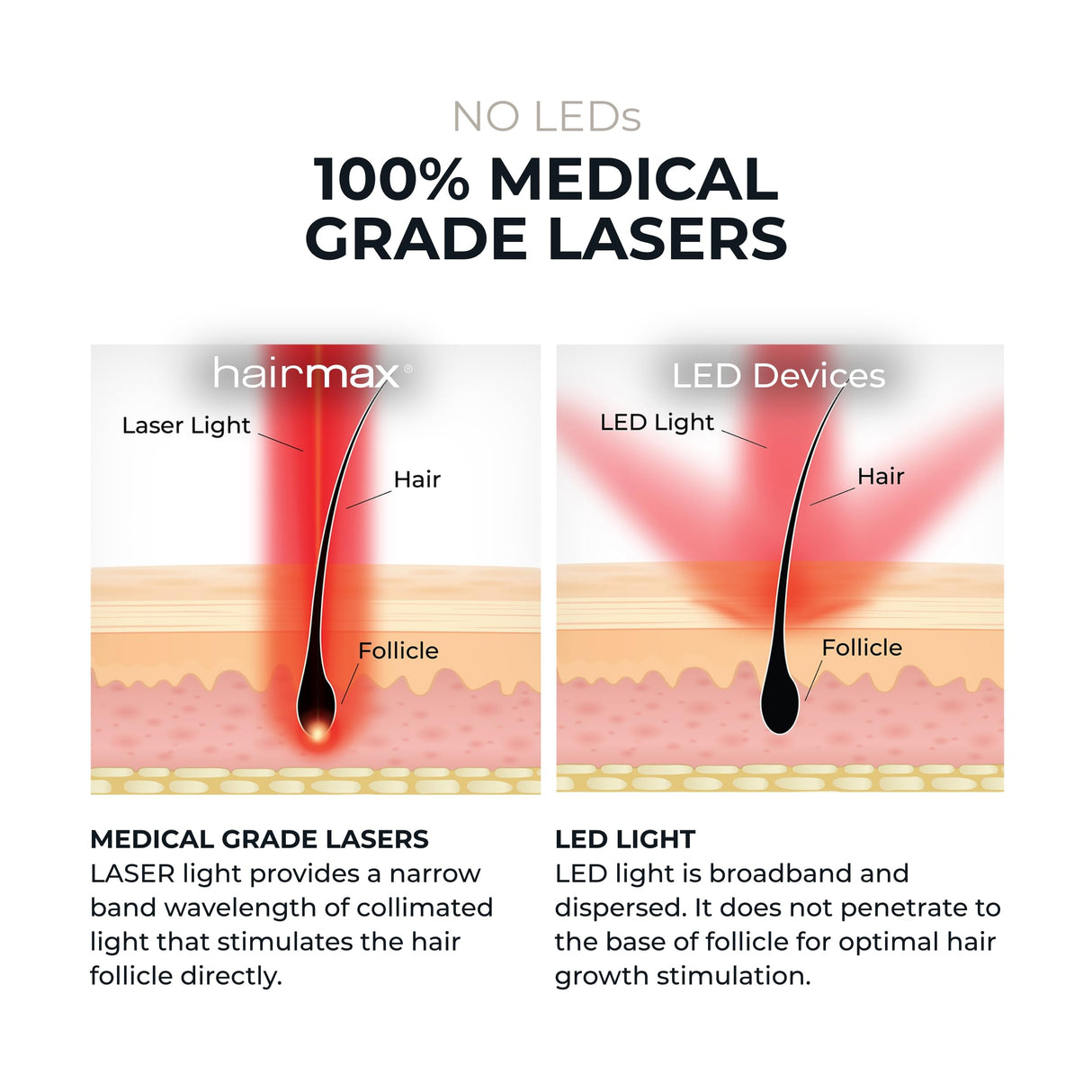 Hairmax LaserBand 82 - Hair Growth and Regrowth Treatment - Restores Natural Hair Cycle - Home-Use Medical Device With Medical Grade Lasers