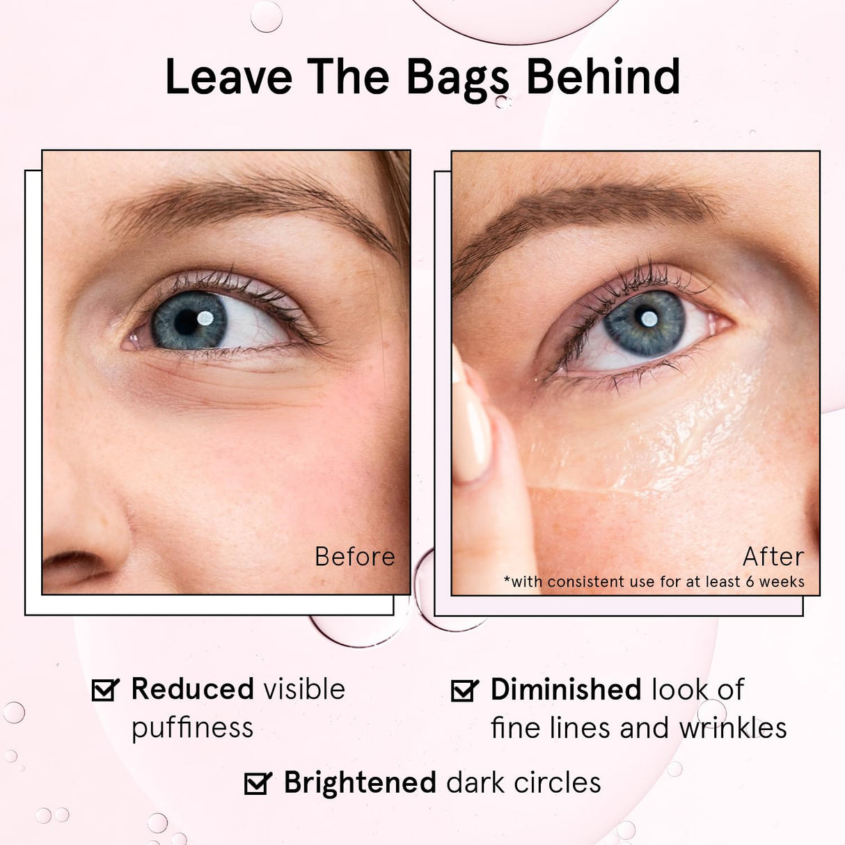 grace & stella Award Winning Under Eye Brightener Roller - Airplane Travel Essentials - Retinol & Caffeine Eye Serum for Puffiness, Dark Circles, Wrinkles - Vegan Skincare (15ml / 0.51floz)