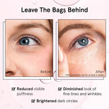 grace & stella Award Winning Under Eye Brightener Roller - Airplane Travel Essentials - Retinol & Caffeine Eye Serum for Puffiness, Dark Circles, Wrinkles - Vegan Skincare (15ml / 0.51floz)