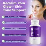 AURA VITAMINS - Vitiligo Capsules 60 Count | 1 Month | Improve Skin Pigmentation Support and Reduce White Spots | Effective Vitiligo Supplement | Natural Solution for White Spots on Skin. (3)