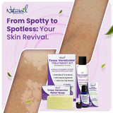 Naturasil Tinea Versicolor Treatment +2 Bars | Max-Strength 10x Soap | Antifungal Micronized Sulfur | Stops Pityriasis, Candida, Ringworm & Irritation | Fast Acting Adult & Kid Safe | 4 oz (2 Pack)