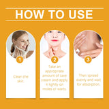 Lenaro Bee Venom Wart and Tag Remover, Lenaro Bee Venom Mole and Wart Treatment Cream, Tag Recede Bee Venom for Skin(2pcs)