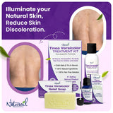 Naturasil Tinea Versicolor Treatment +2 Bars | Max-Strength 10x Soap | Antifungal Micronized Sulfur | Stops Pityriasis, Candida, Ringworm & Irritation | Fast Acting Adult & Kid Safe | 4 oz (2 Pack)