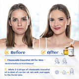 HIQILI 100ML Chamomile Essential Oil, Pure & Natural Chamomile Oil for Diffueser, Skin, Soap, Shampoo - 3.38 Fl Oz