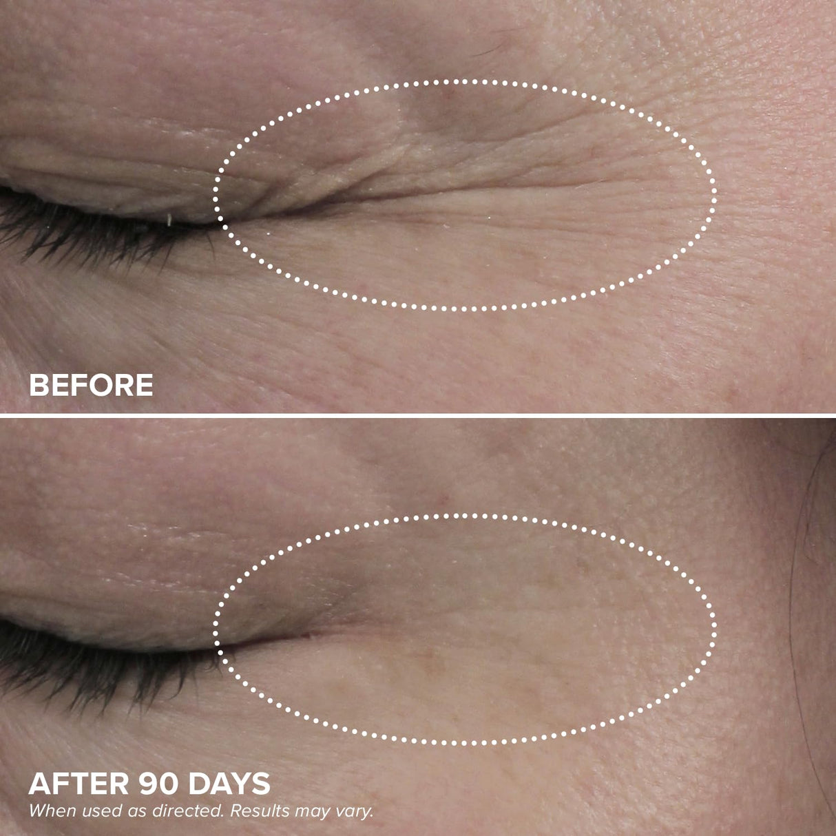 DRMTLGY HPR Eye Cream - Retinoid Under Eye Cream for Under Eyes, 0.5 fl oz