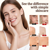 Grass-Fed Beef Tallow Balm for Skin with Raw Honey - Face & Body Moisturizer - Natural Whipped Skin Care Cream for Dry Skin- Hydrating Body Lotion for Nourishment (50g/1.76oz)