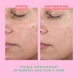 Drunk Elephant Bora Barrier Repair Cream - 50 ml/1.69 fl oz - Ultra-Rich Moisturizer - Clean Clinical Skincare - Cruelty-Free - Dermatologist-Tested - Free of Essential Oils, Silicones, and Fragrance