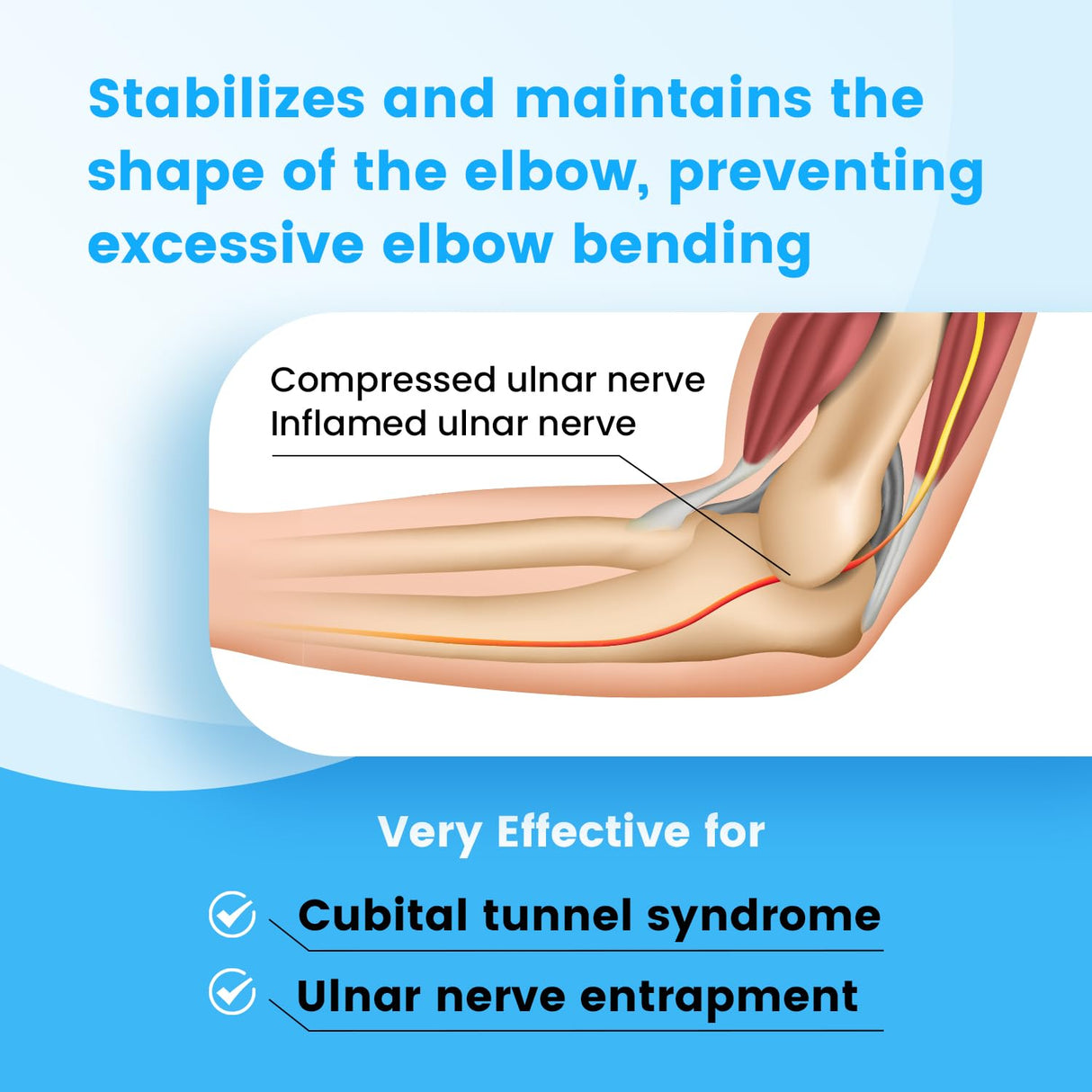 Cubital Tunnel Syndrome Elbow Brace, Ulnar Nerve Entrapment Splint, Elbow Immobilizer for Night Sleeping and Day Working, 4 Angles Adjustable, Fit Women & Men, Right & Left Arm - S/M