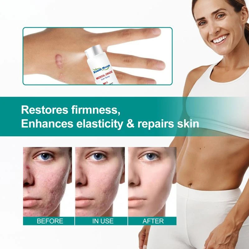South Moon （Buy 1 Get 1 Free）South Moon Scar Care Spray Fades Scare pregnancy  Smoothing Skin Care Spray Medical Grade Scar Spray - Specification: Buy 2 Get 2 Free