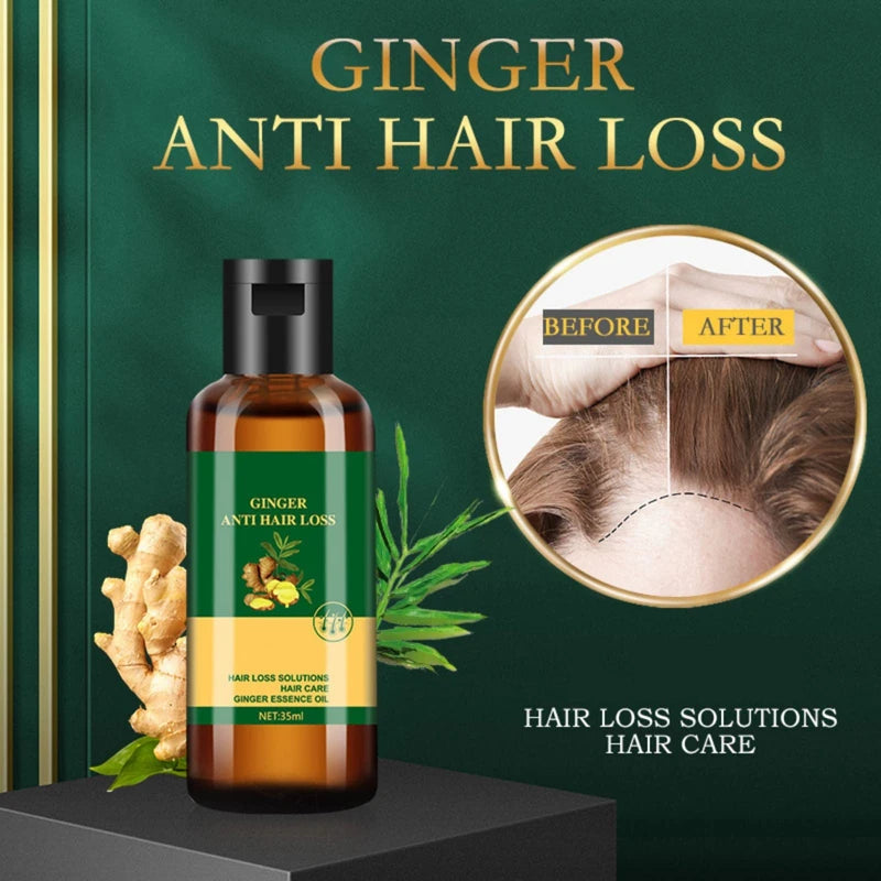 Lidoria Ginger Anti Hair Loss 7 Days, Ginger Essential Oil for Hair Growth Stronger and Fuller Hair, Hair Growth Serum for women for Dry Damaged Hair, Thicker Longer Hair (1.2 Oz(Pack of 2))