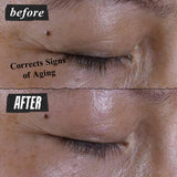 Kiehl's Super Multi-Corrective Eye Cream, Anti-Aging Cream that Lifts Brow Bone Area, Smooths and Firms Eye Lids, Bilberry Seed Extract and Collagen Peptide for Smoother Looking Skin - 0.95 fl oz